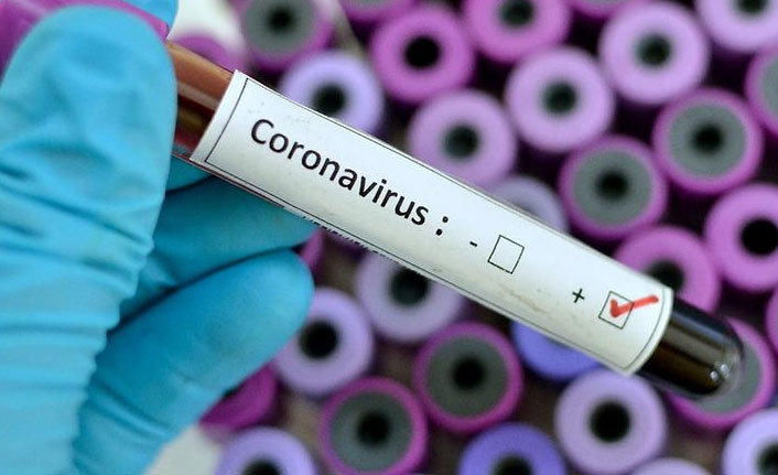 Türkiye'de son 24 saatte 7 bin 112 kişinin Kovid-19 testi pozitif çıktı