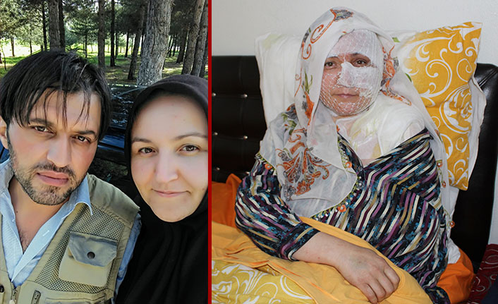 Eşinin üzerine kızgın yağ döktüğü kadın: Ölmek istemiyorum!