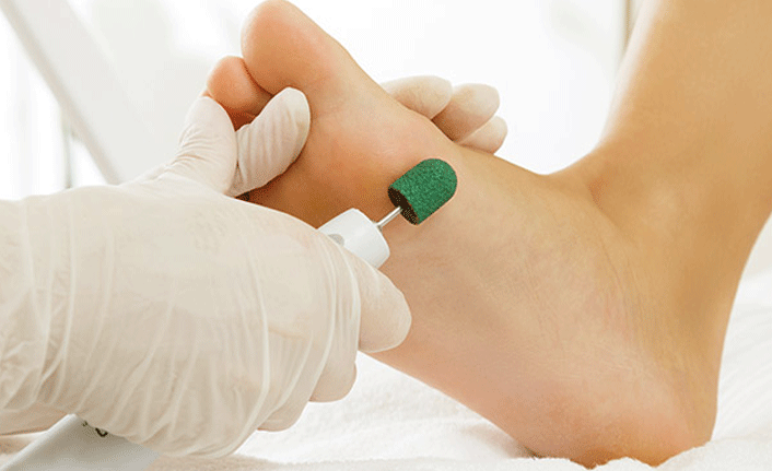 "Pedikür yaptırırken parmağınızdan olmayın"