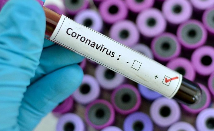 Kovid-19'la mücadelede günlük vefat sayısı 75 gün sonra ilk kez 100'ün altına geriledi