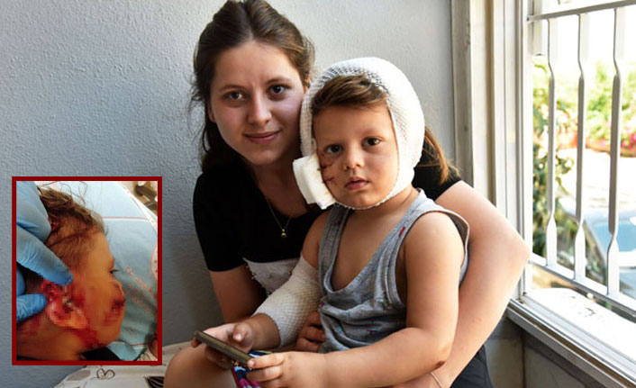 Köpeğin kafasını ısırdığı küçük çocuk ölümden döndü