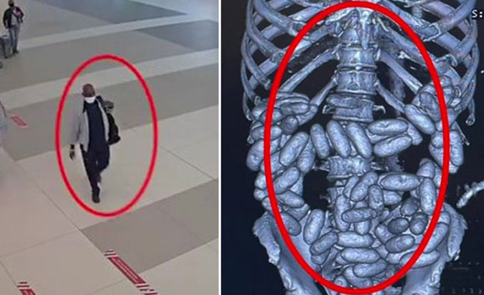 Yolcunu midesinden bin 844 gram kokain çıktı