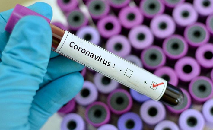 Türkiye'de 6 bin 408 kişinin Kovid-19 testi pozitif çıktı