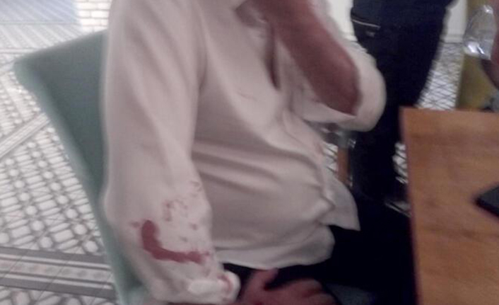 Belediye başkanına taşlı sopalı saldırı