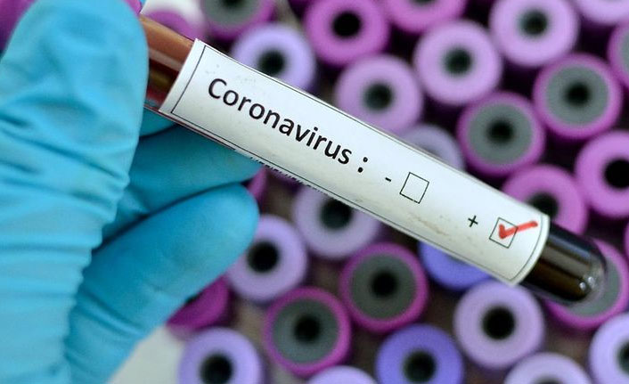 Türkiye'de son 24 saatte 5 bin 955 kişinin testi pozitif çıktı