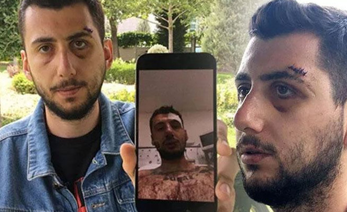 Eski sevgili muştayla dehşeti yaşattı!