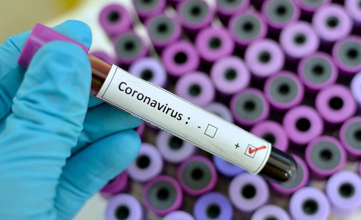 Türkiye’de Günlük Koronavirüs Verileri Açıklandı: 59 Kişi Yaşamını Yitirdi