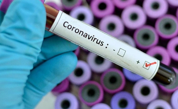 Türkiye’de Günlük Koronavirüs Tablosu: 59 Kişi Hayatını Kaybetti