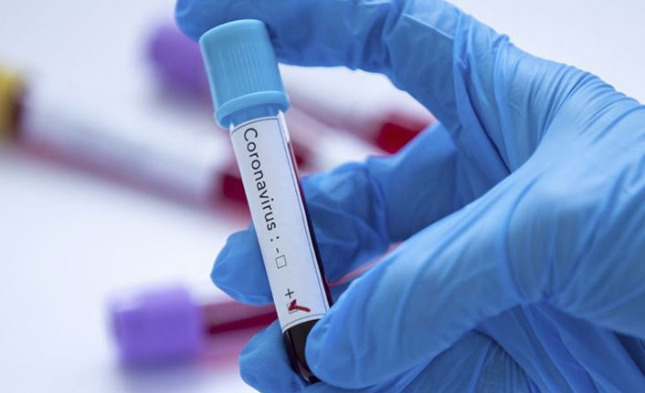 Lambda varyantı Latin Amerika'da yayılıyor