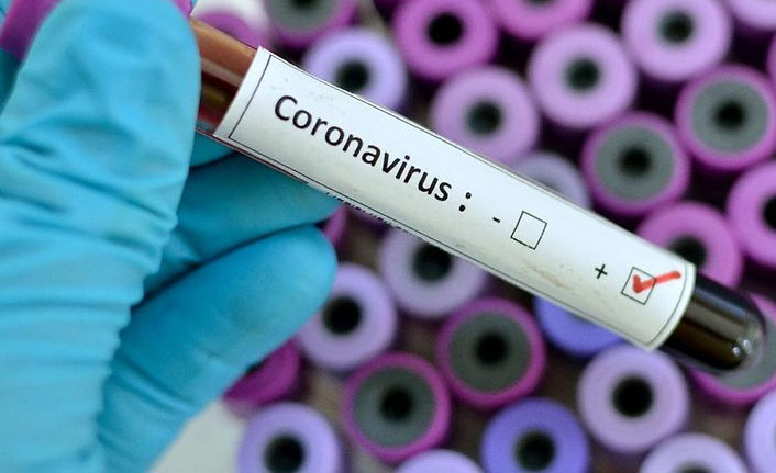 Türkiye’de son 24 saatte 5 bin 266 yeni vaka