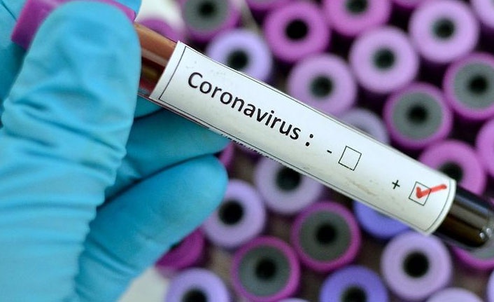 Türkiye’de son 24 saatte 5 bin 283 yeni vaka