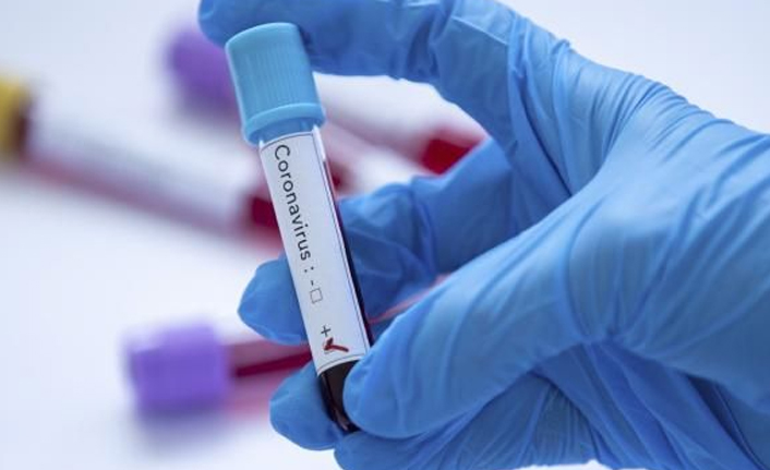 Türkiye'de 5 bin 846 kişinin Kovid-19 testi pozitif çıktı, 53 kişi yaşamını yitirdi