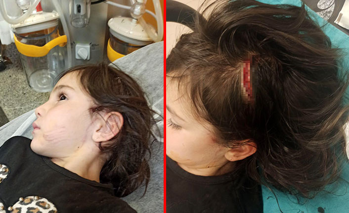 Sevmeye çalıştığı köpek küçük kıza dehşeti yaşattı