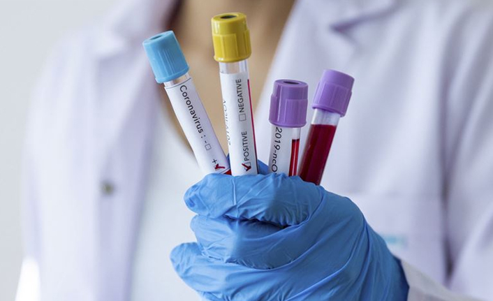 Türkiye’nin günlük koronavirüs ve aşı verileri açıklandı