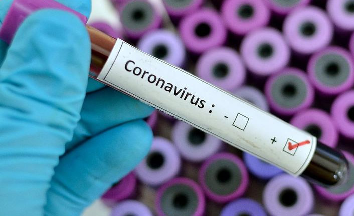 Türkiye’nin günlük koronavirüs tablosu açıklandı: 49 can kaybı, 5.404 vaka