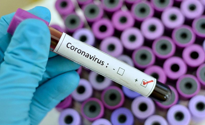 Türkiye’de günlük vaka sayısı 12 bini aştı: 58 kişi yaşamını yitirdi