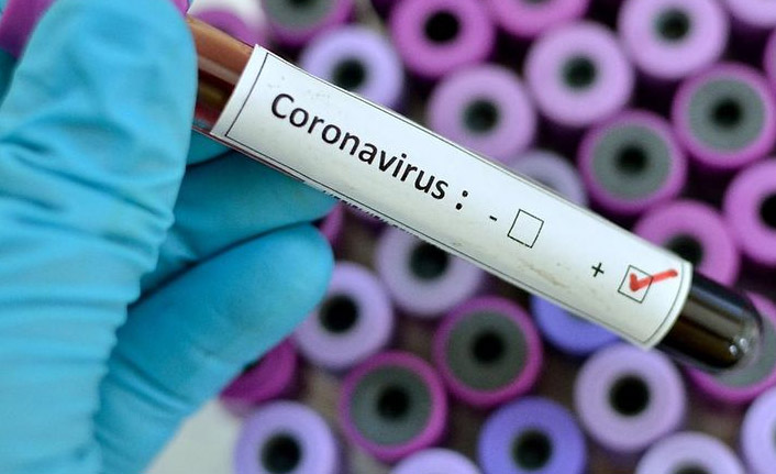 Türkiye’de Günlük Kovid-19 Tablosu: 22 Bin 291 Yeni Vaka Tespit Edildi