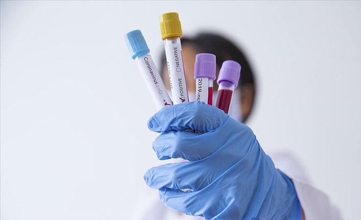 Tokyo Olimpiyatları'nda 241 akredite kişi Kovid-19 oldu