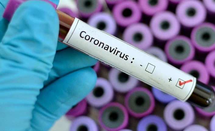 Türkiye’nin günlük Kovid-19 tablosu açıklandı: 22 bin yeni vaka