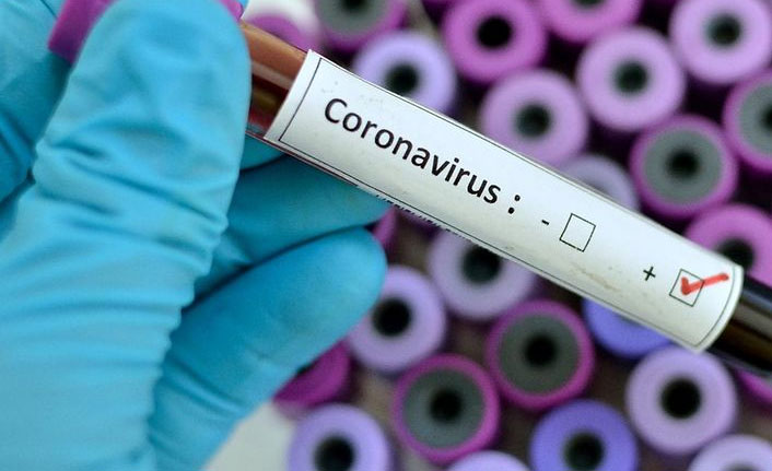 Türkiye'de son 24 saatte 26 bin 597 yeni Kovid-19 vakası