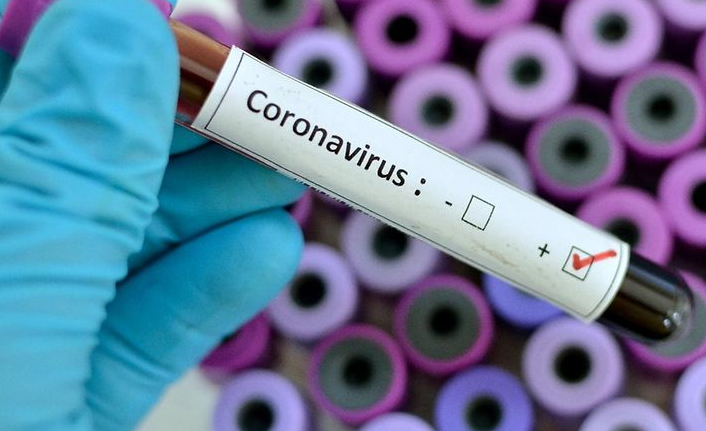 Türkiye’de son 24 saatte 18 bin 622 yeni vaka tespit edildi