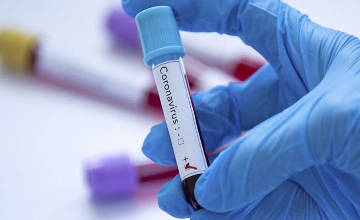 Türkiye’de koronavirüs vakaları yeniden artışta: 19 bin 616 yeni vaka