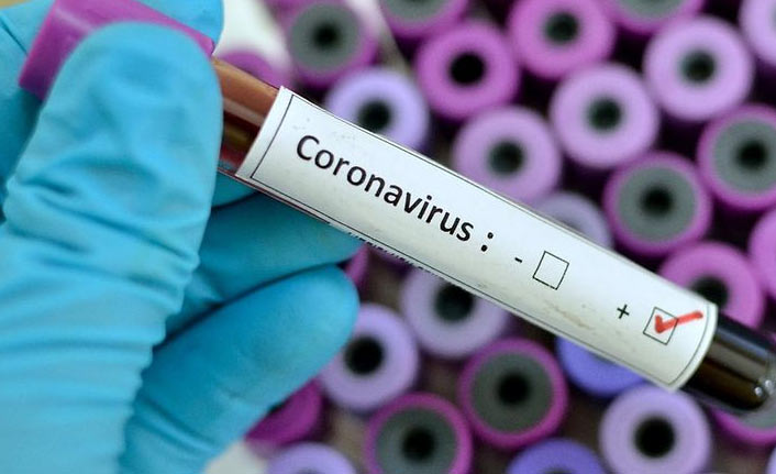 Türkiye’de son 24 saatte 19 bin 557 yeni vaka tespit edildi