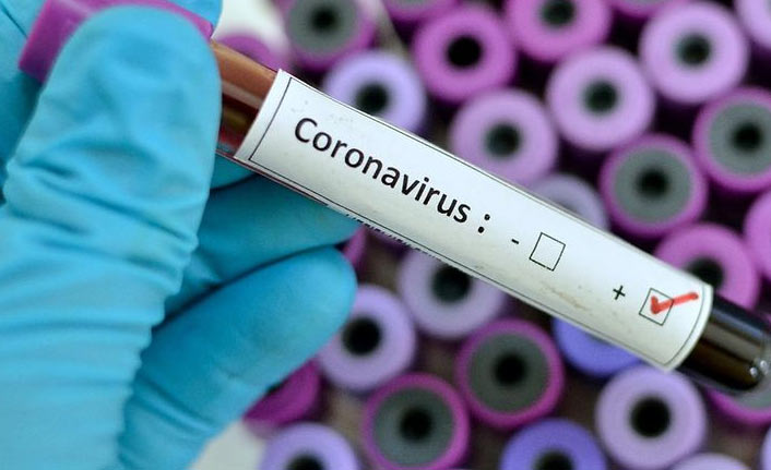 Son 24 saatte 23 bin 496 yeni vaka, 283 kişi hayatını kaybetti