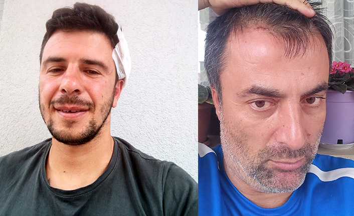 Trabzon'da antrenörlerin futbol sohbetinde levyeli kavga çıktı: 2 yaralı