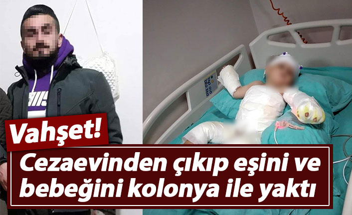 Vahşet! Cezaevinden çıkıp eşini ve bebeğini kolonya ile yaktı