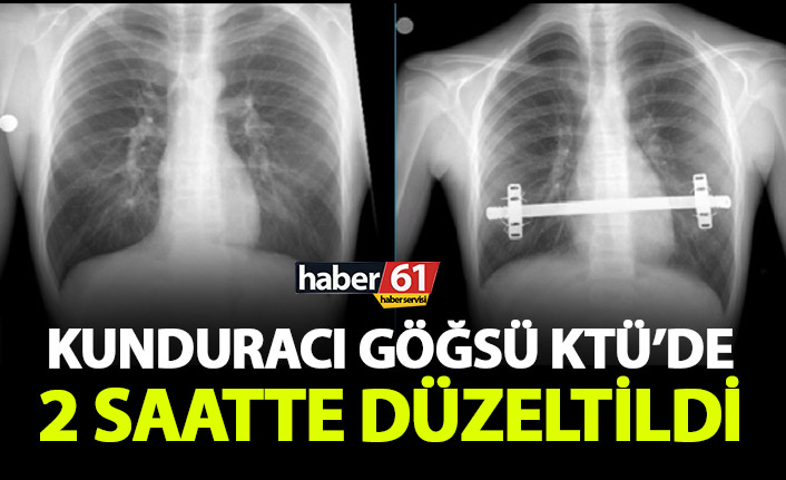 Kunduracı göğsü KTÜ Farabi Hastanesinde 2 saatte düzeltildi