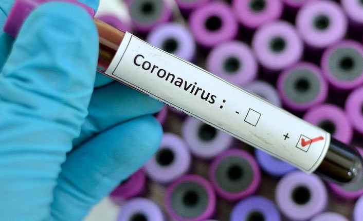 Türkiye’de son 24 saatte 28 bin 810 yeni Kovid-19 vakası