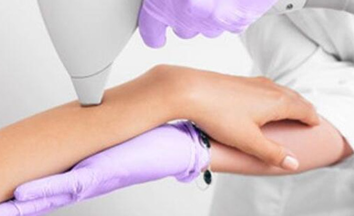 Lazer Epilasyon Size Hangi Faydaları Sağlar?