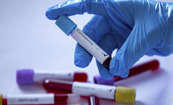 Türkiye’de 28 bin 370 yeni vaka: 196 kişi hayatını kaybetti