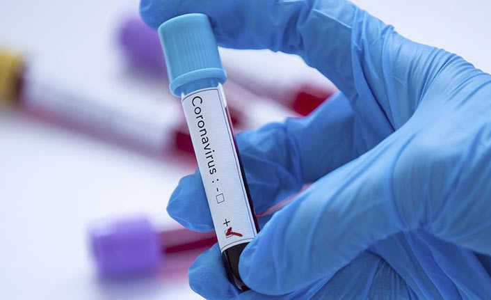 Türkiye’de 31 bin 248 yeni vaka, 236 can kaybı