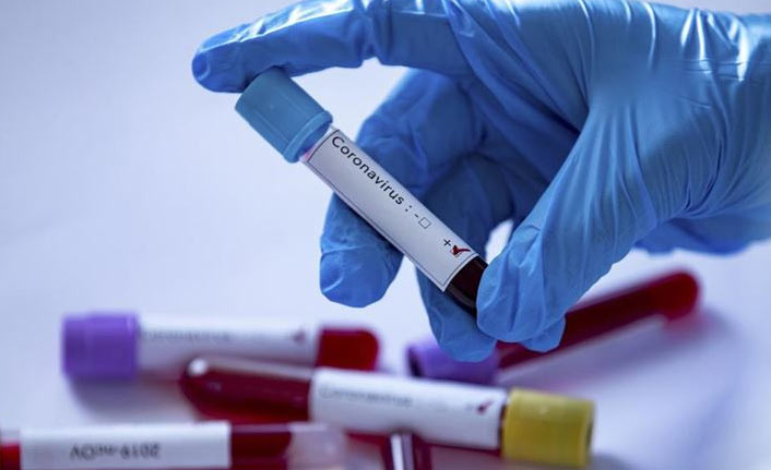 Türkiye'de son 24 saatte 30 bin 694 yeni vaka tespit edildi