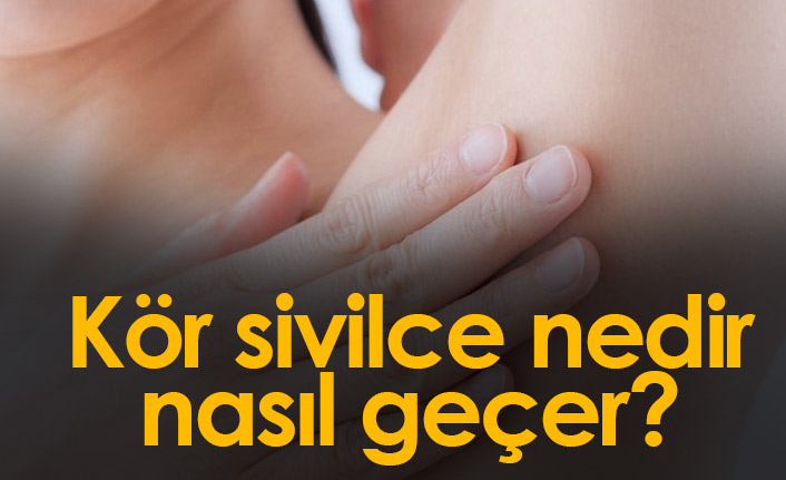 Koltuk altında ucu olmayan kör sivilce neden olur? Kasıkta çıkan sivilceler nedir?