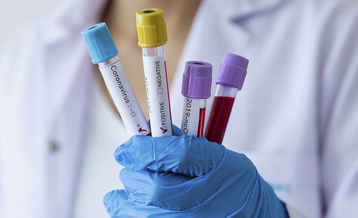 Türkiye'nin günlük koronavirüs ve aşı tablosu açıklandı - 22 Ekim 2021 Cuma