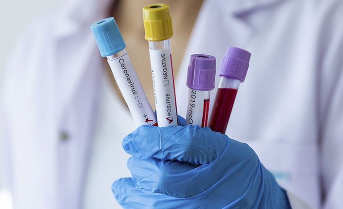 Günlük koronavirüs tablosu ve aşı oranları açıklandı