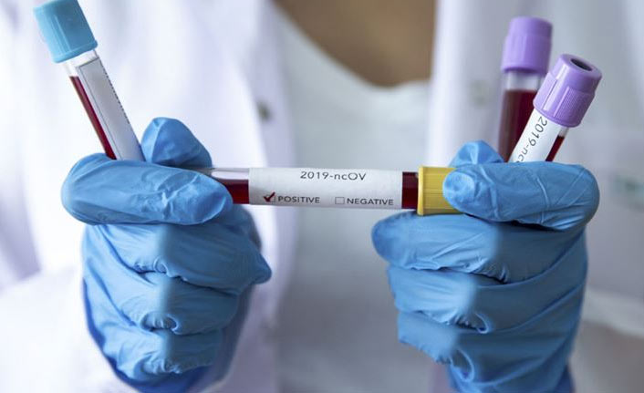 ABD'deki araştırma korkuttu! Covid19'un etkileri...