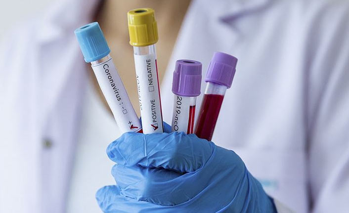 Türkiye’de 25 bin 528 yeni vaka, 229 can kaybı