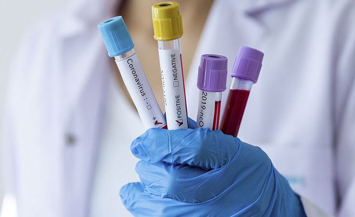 Türkiye’de 24 saatte 23 bin 948 yeni Kovid-19 vakası tespit edildi