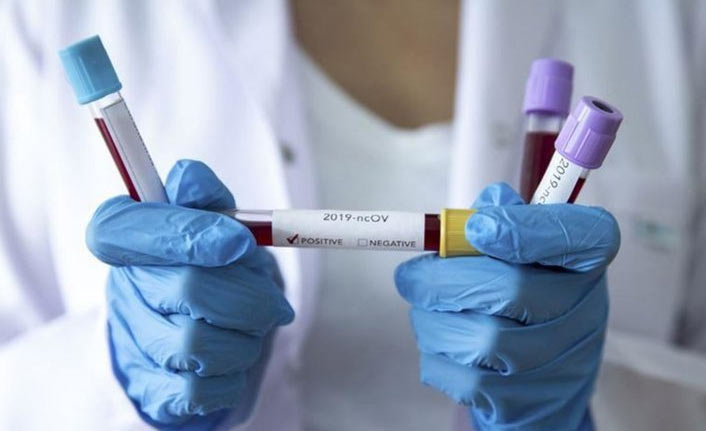 Bilim Kurulu’ndan 3. doz kararı: Yeni uygulama kimleri kapsıyor?