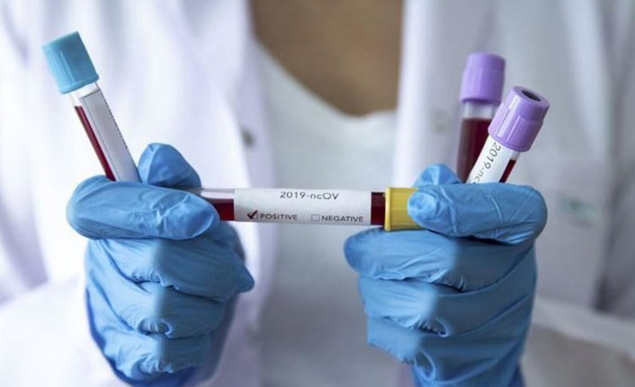 Türkiye’de son 24 saatte 27 bin 474 yeni Kovid-19 vakası