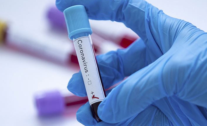 Türkiye’de 24 saatte 24 bin 898 yeni Kovid-19 vakası tespit edildi