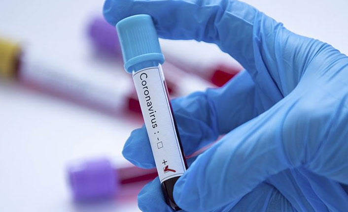 Türkiye’de son 24 saatte 21 bin 624 yeni vaka, 189 can kaybı