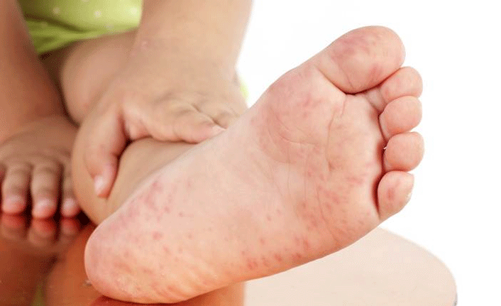 Çocuklarda mevsim hastalığına dikkat!