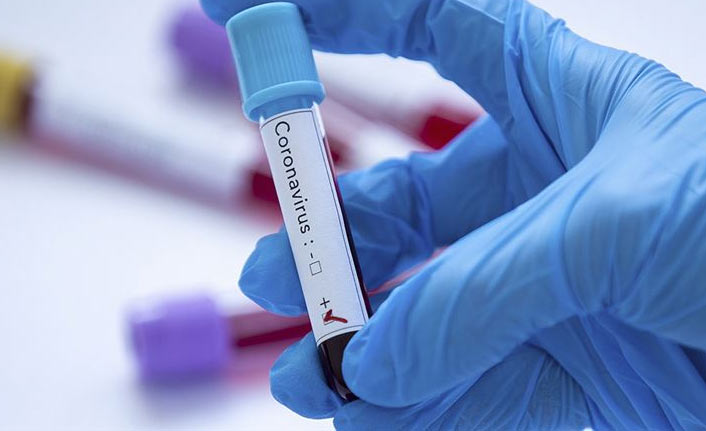 Türkiye’de son 24 saatte 27 bin 592 yeni Kovid-19 vakası