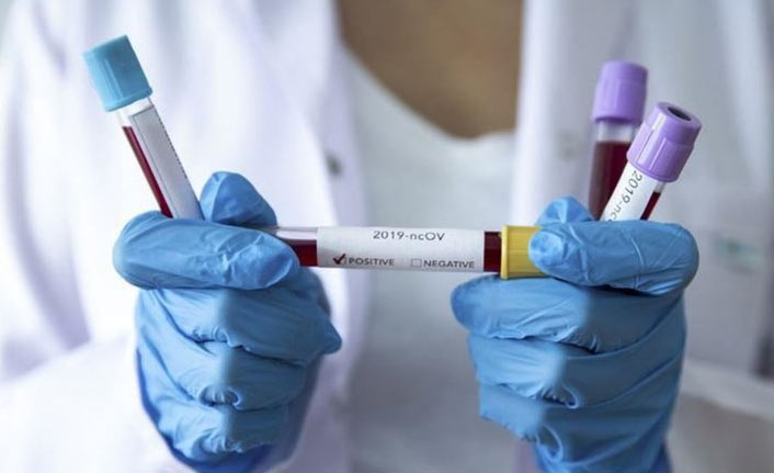 Sağlık Bakanı Koca: Türkiye’de Nu varyantına rastlanmadı