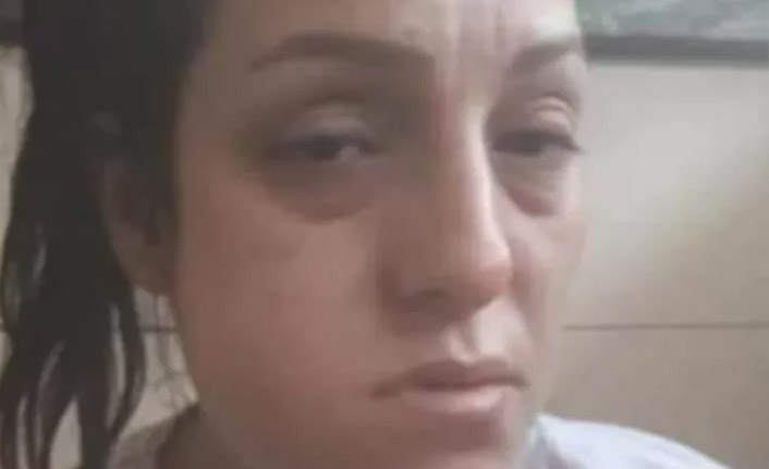 16 bin liraya diş yaptırdı, başına gelmeyen kalmadı!